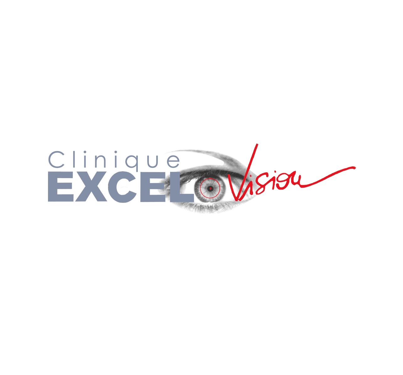EXCEL-VISION